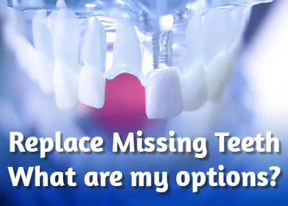 Tooth-Replacement-Options