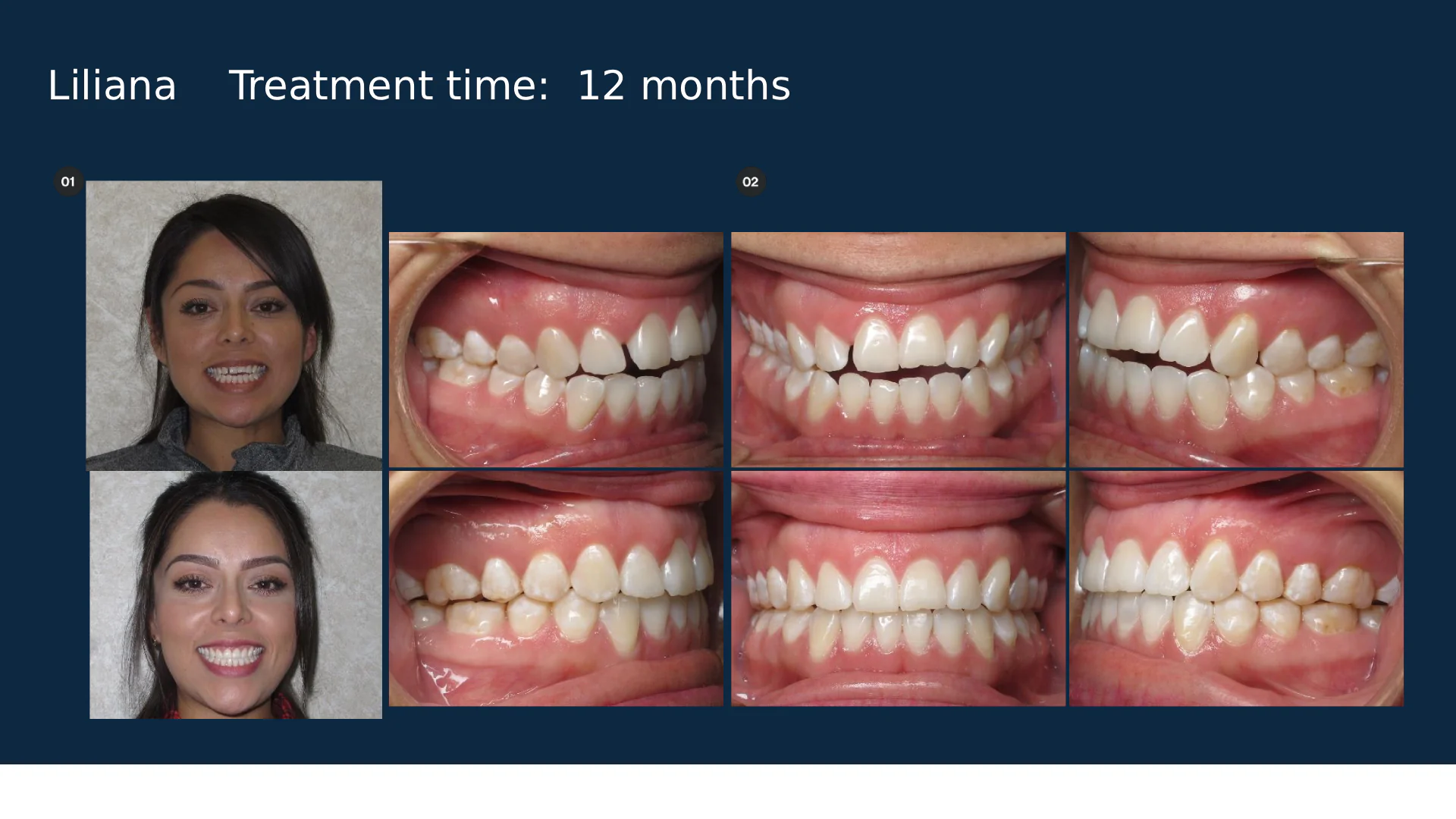 before-after-slide-10