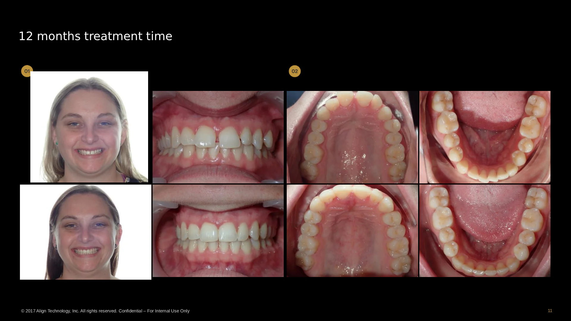 before-after-slide-11
