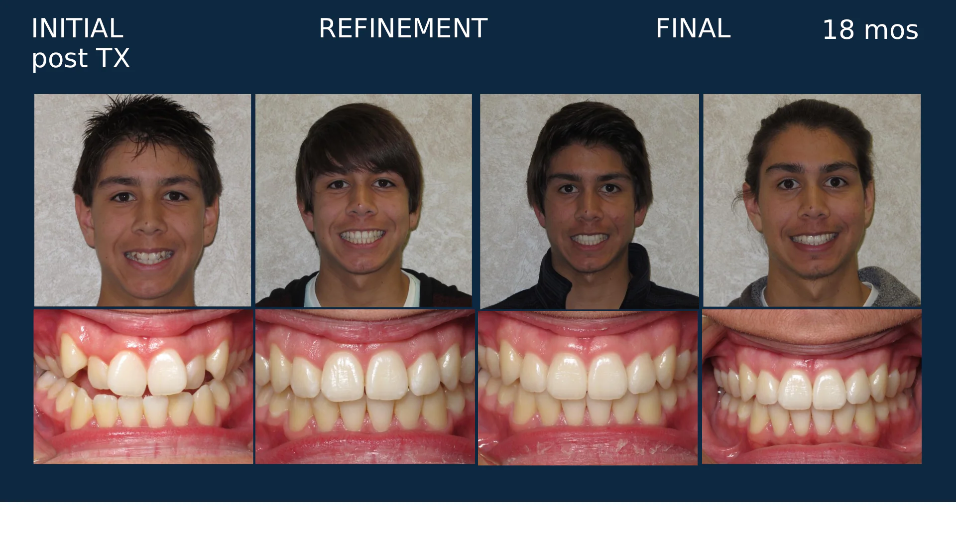 before-after-slide-14