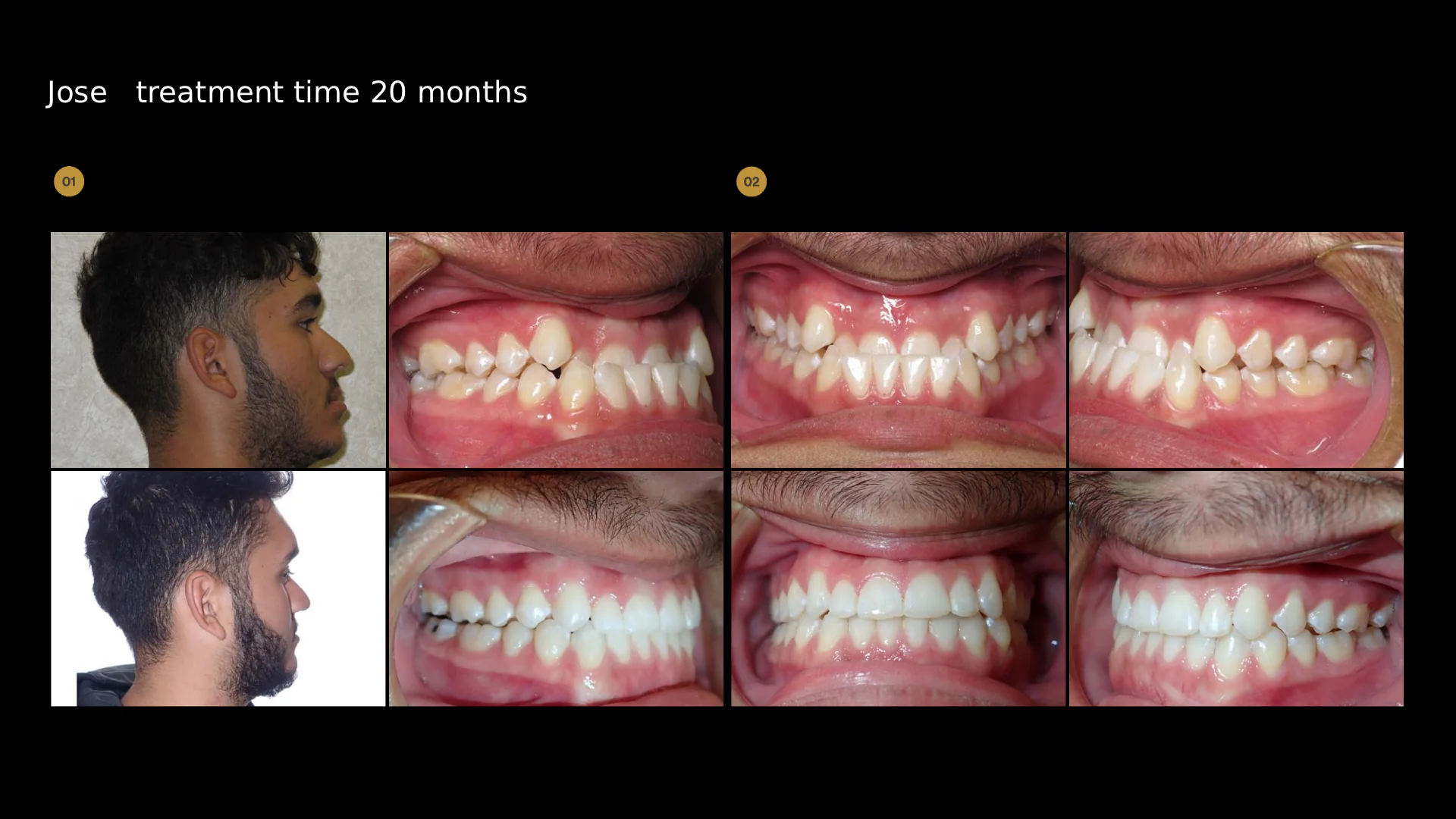 before-after-slide-18
