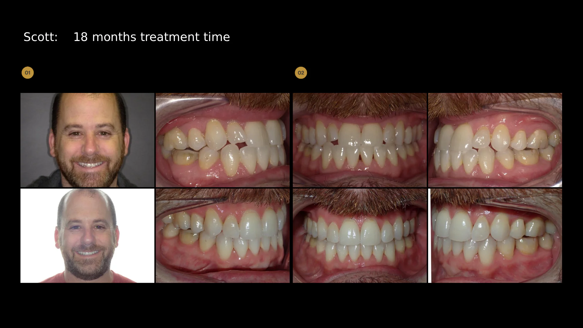 before-after-slide-21