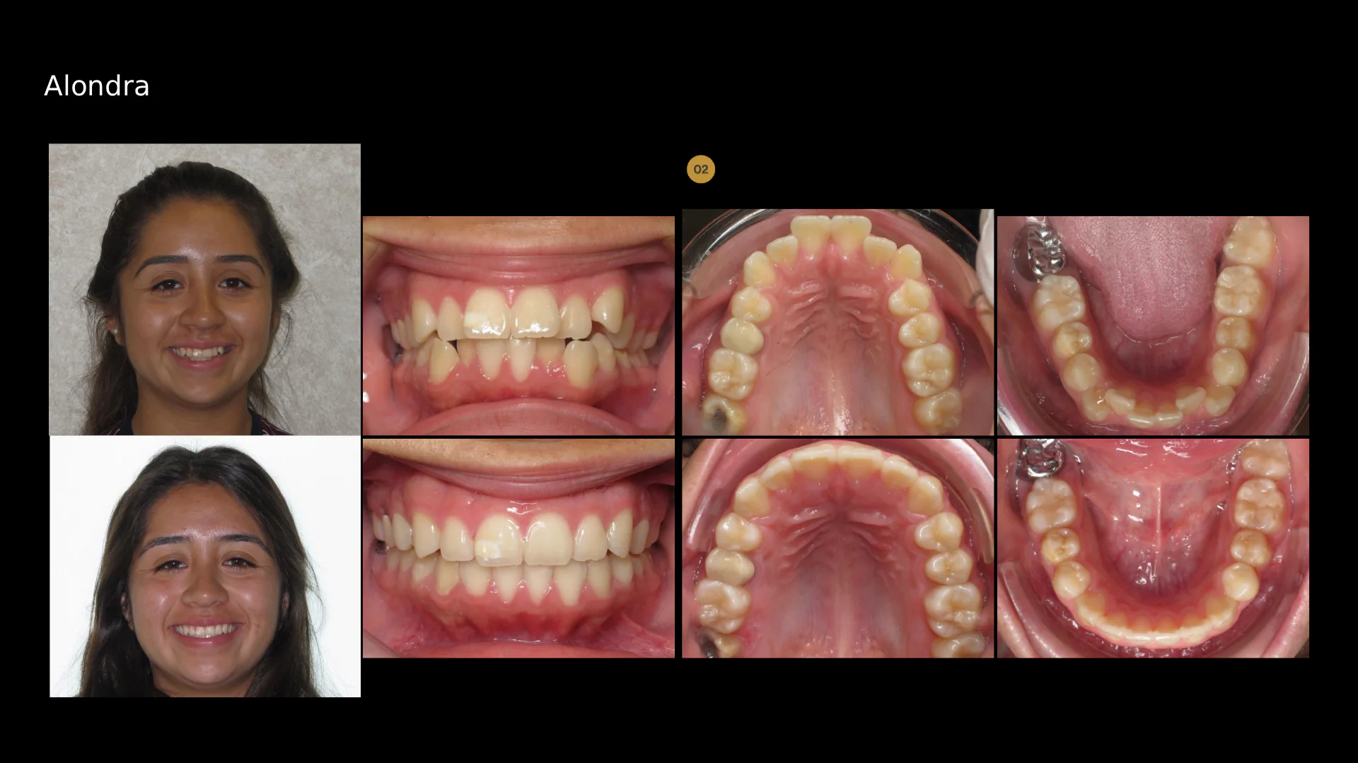 before-after-slide-7