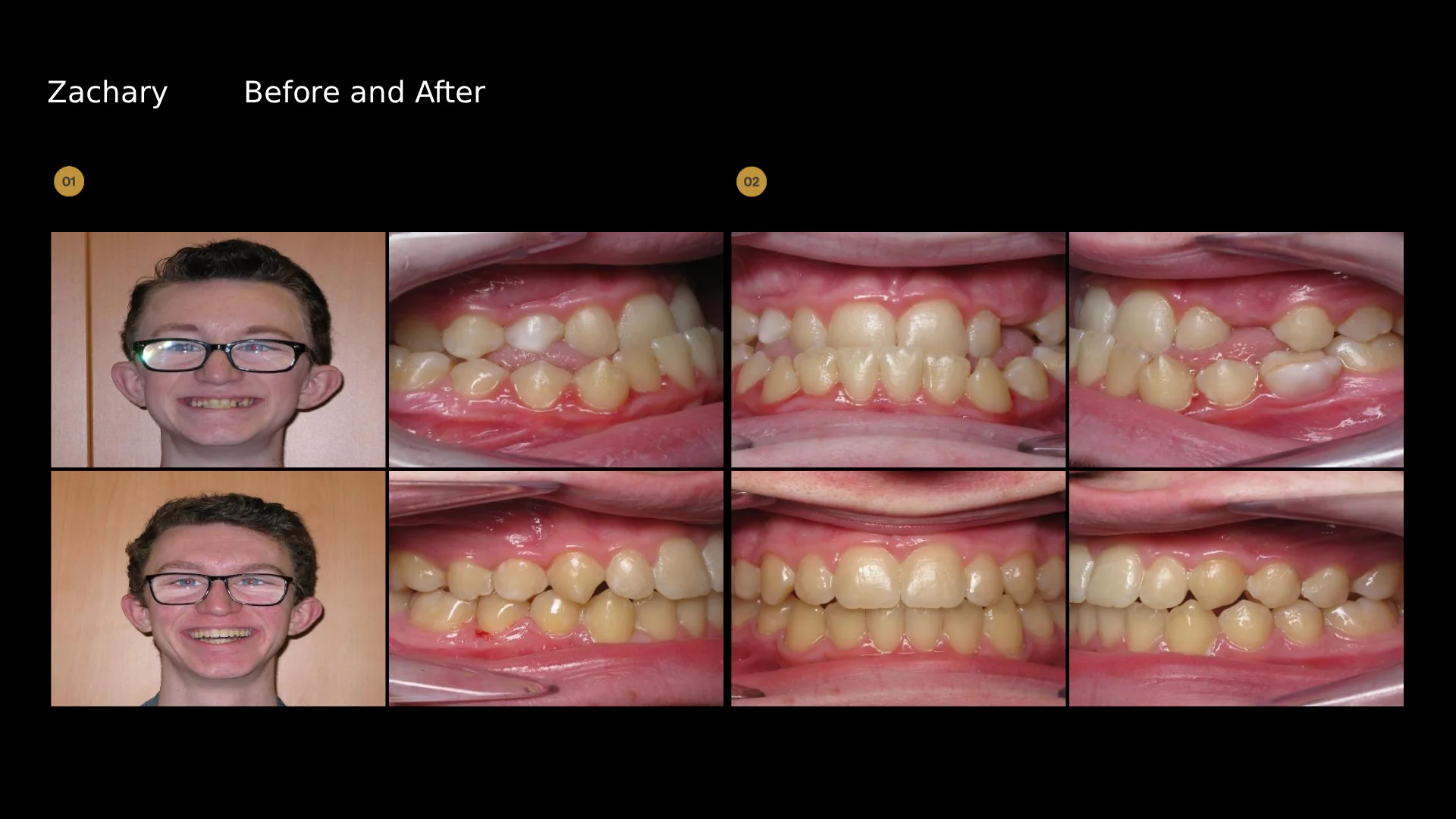 before-after-slide-9
